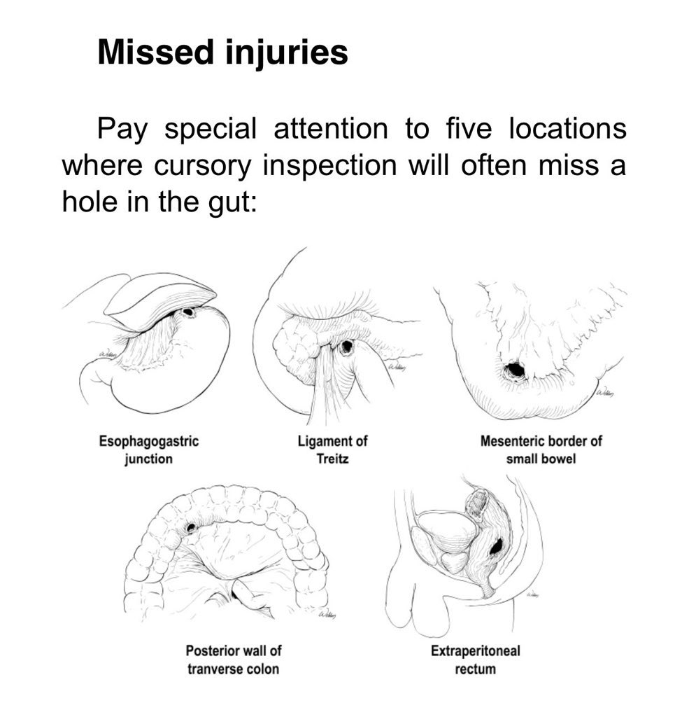 CiruAndes2's tweet photo. The 5 main locations for missed injuries during trauma laparotomy by Dr @kmattox1! @juliomayol @SWexner @pferrada1 @almagoch @PipeCabreraV @salo75 @TomVargheseJr https://t.co/e5mNwUMYCU
