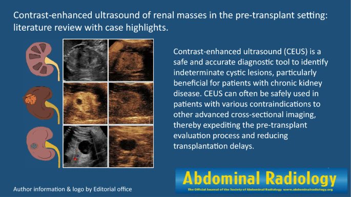 Abdominal Radiology (@abdominal_rad) on Twitter photo Contrast-enhanced ultrasound of renal masses in the pre-transplant setting: literature review with case highlights
link.springer.com/article/10.100…
Barkovich KJ et al.
<a href="/KhuranaBody/">Aman Khurana</a>
@UCSDBodyRad
#AbdRadJ
<a href="/RadGeek/">Neeraj Lalwani</a>
@bobmarks76
<a href="/LetDdiceFlyHigh/">Sandeep Arora</a> Contrast-enhanced ultrasound of renal masses in the pre-transplant setting: literature review with case highlights
link.springer.com/article/10.100…
Barkovich KJ et al.
<a href="/KhuranaBody/">Aman Khurana</a>
@UCSDBodyRad
#AbdRadJ
<a href="/RadGeek/">Neeraj Lalwani</a>
@bobmarks76
<a href="/LetDdiceFlyHigh/">Sandeep Arora</a>