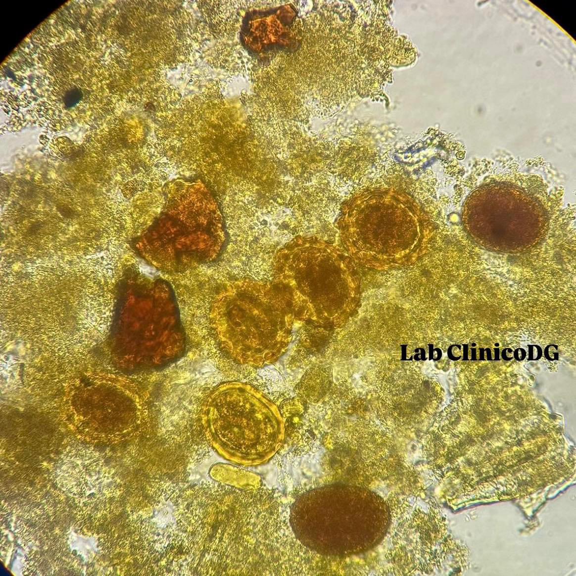 LabClinicoDG's tweet photo. Ascaris lumbricoides 🔬🪱

https://t.co/0WN21wbNvA

#parasitologia #ascarislumbricoides https://t.co/ZNa2UPrk9K