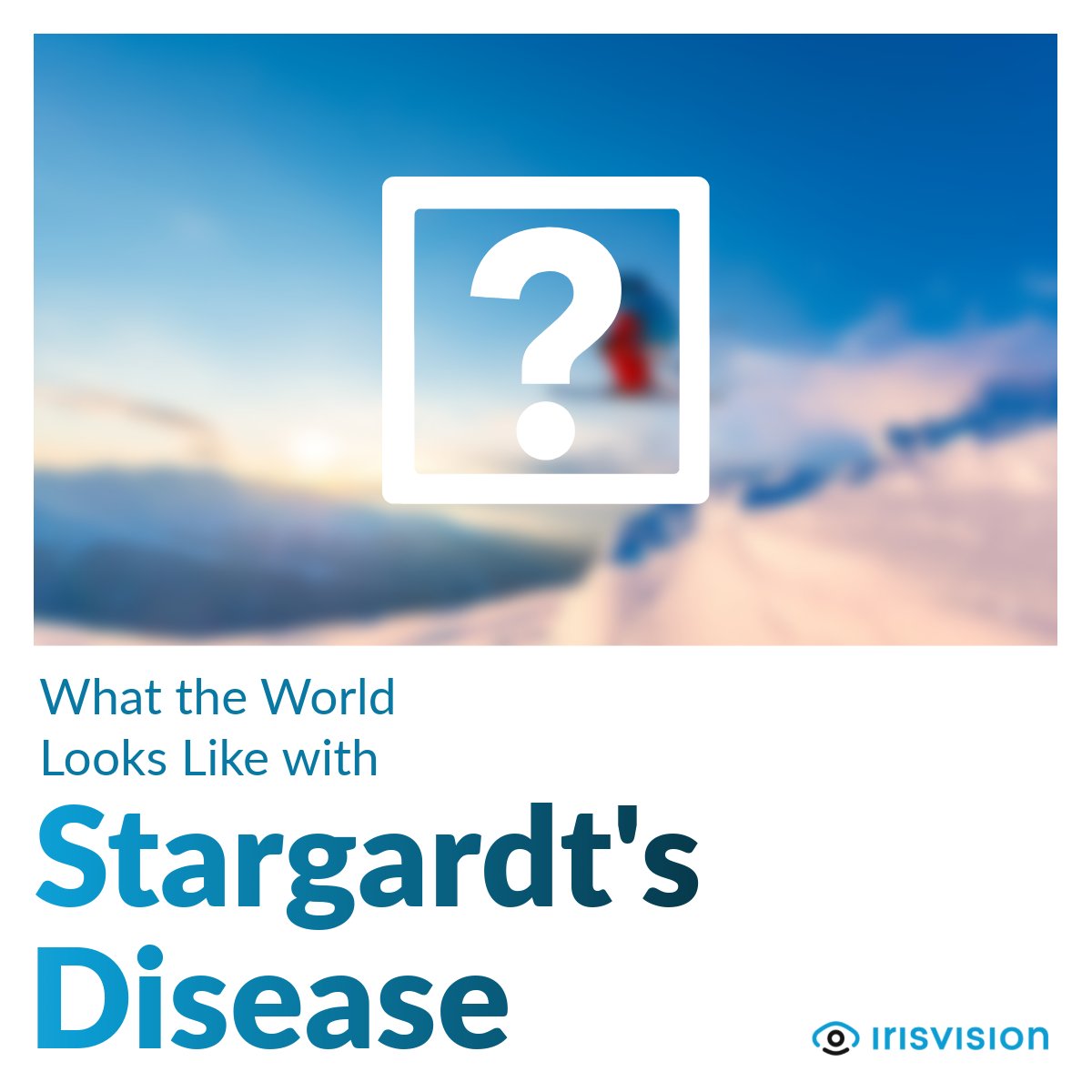 IrisVision tweet media