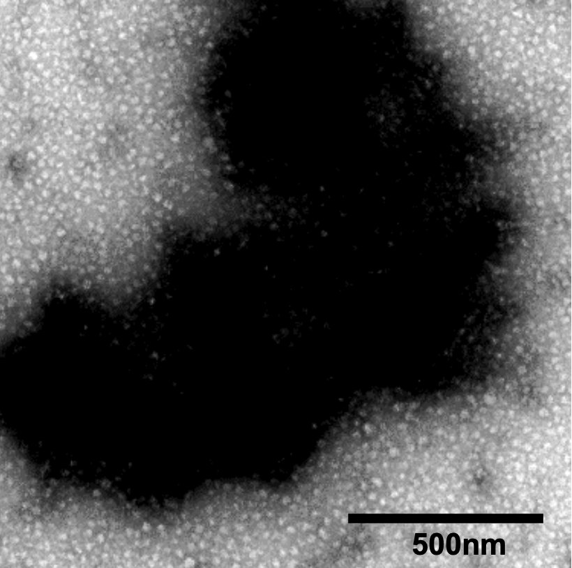 Studying ribosomes? Read this work by <a href="/DjuranovicLab/">Sergej Djuranovic</a> and <a href="/slavicaPD/">slavica pavlovic djuranovic</a>—as it presents one of the most rapid and cost-efficient methods to isolate ribosomes from rare organisms or small biomass quantities 💪biorxiv.org/content/10.110…