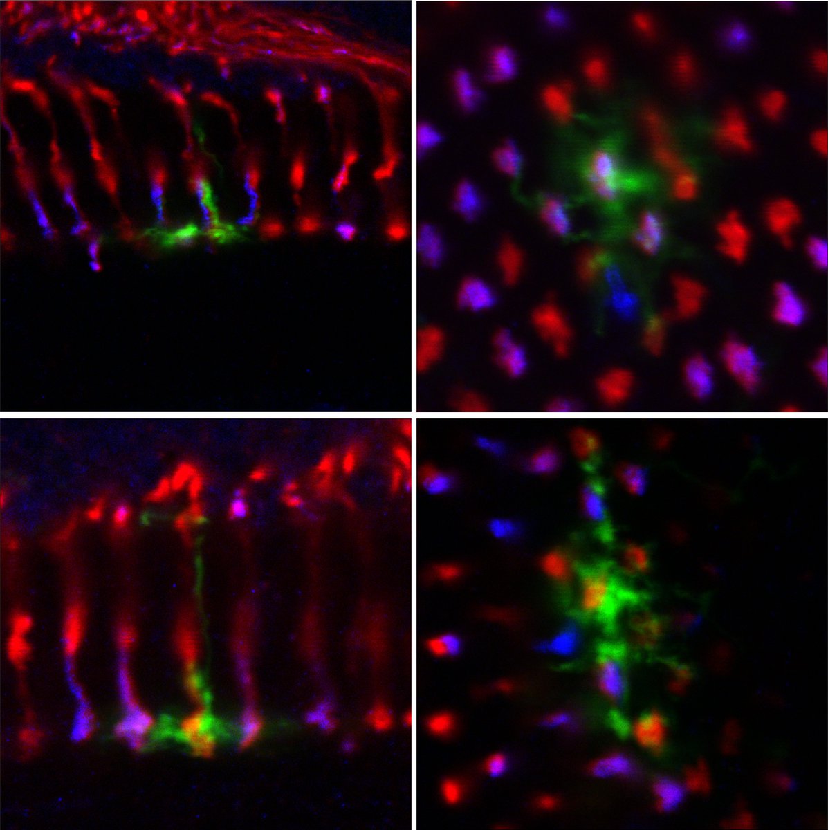 .<a href="/YCDavidChen/">Yu-Chieh David Chen</a> of <a href="/nyuniversity/">New York University</a> will kick off the #SDBPostdocSeminar with his talk "Wiring up the brain during development: Coordination and propagation of cell fate choice in neural circuit assembly" Image: y (top) and p (bottom) Dm8 cells (green) in the fly visual system