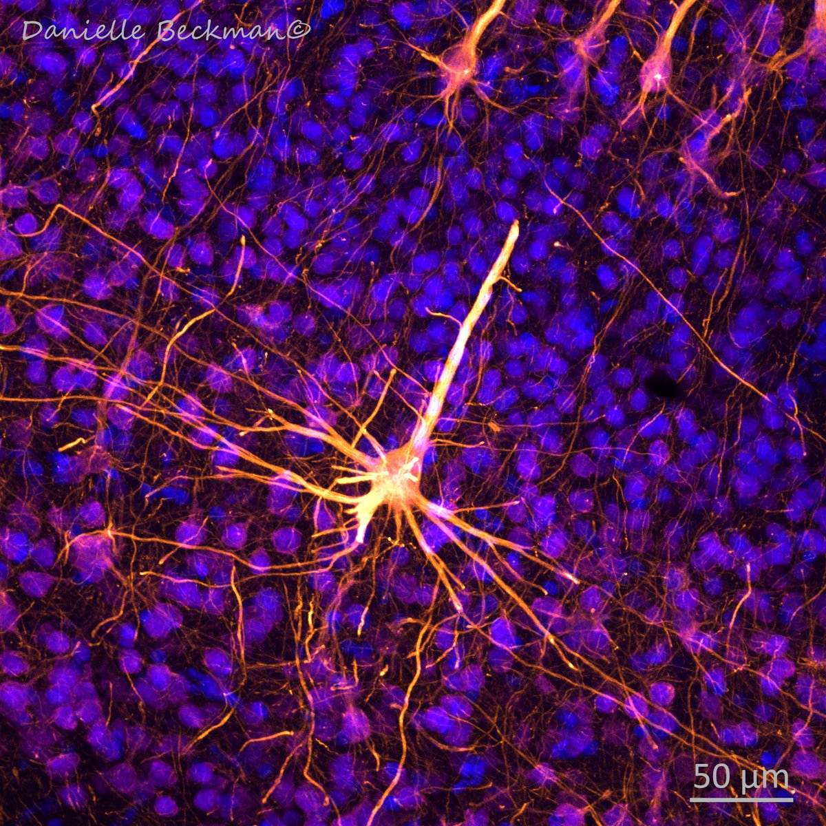 Emotional support neuron pass through your timeline. They are also overwhelmed and multitasking look at them! 🔬🧠