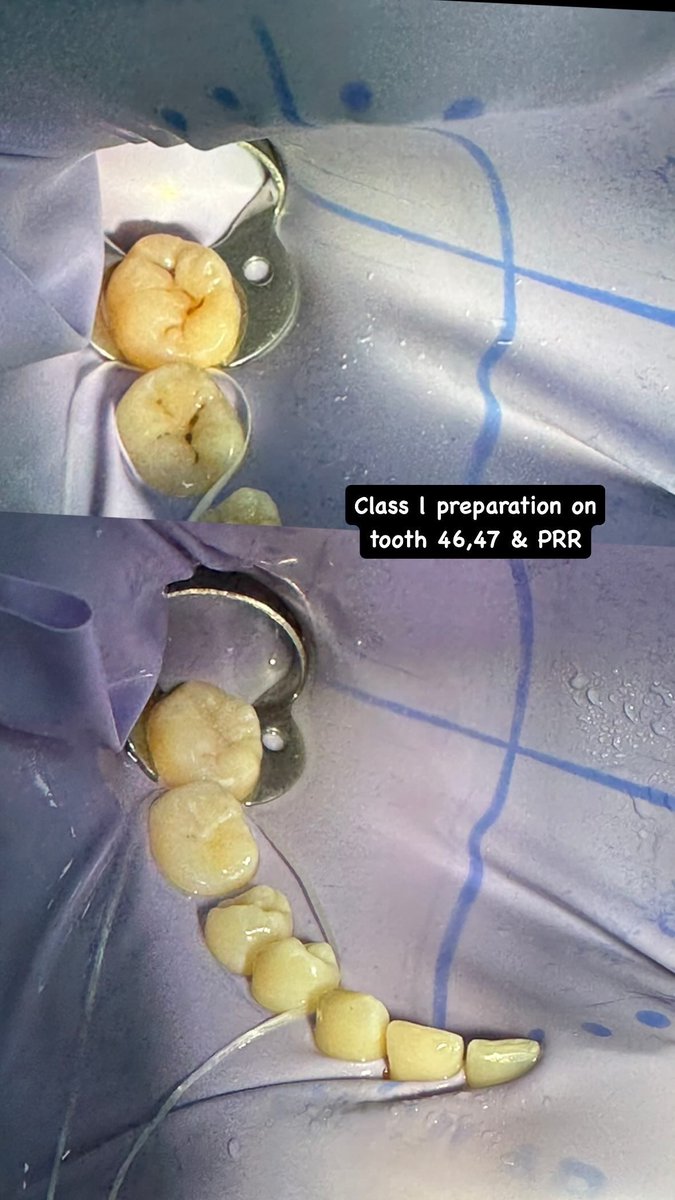 Dr.Raed 🦷 tweet media