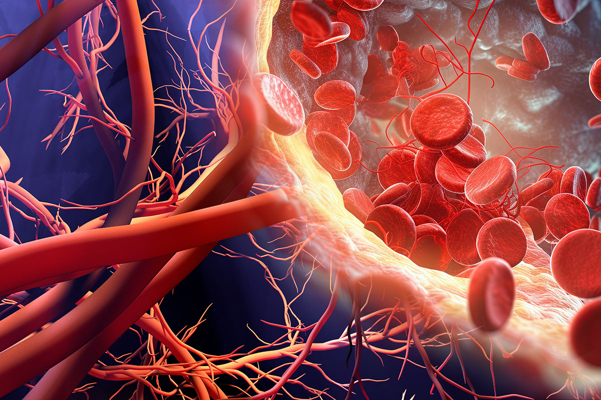 ACCinTouch's tweet image. ICYMI: A QFR-guided #revascularization strategy did not provide the same prognostic benefits as an FFR-guided strategy for patients w/ intermediate coronary stenosis, based on findings from the FAVOR III Europe trial presented at #TCT2024. Get the details: bit.ly/3A9K4Xf…