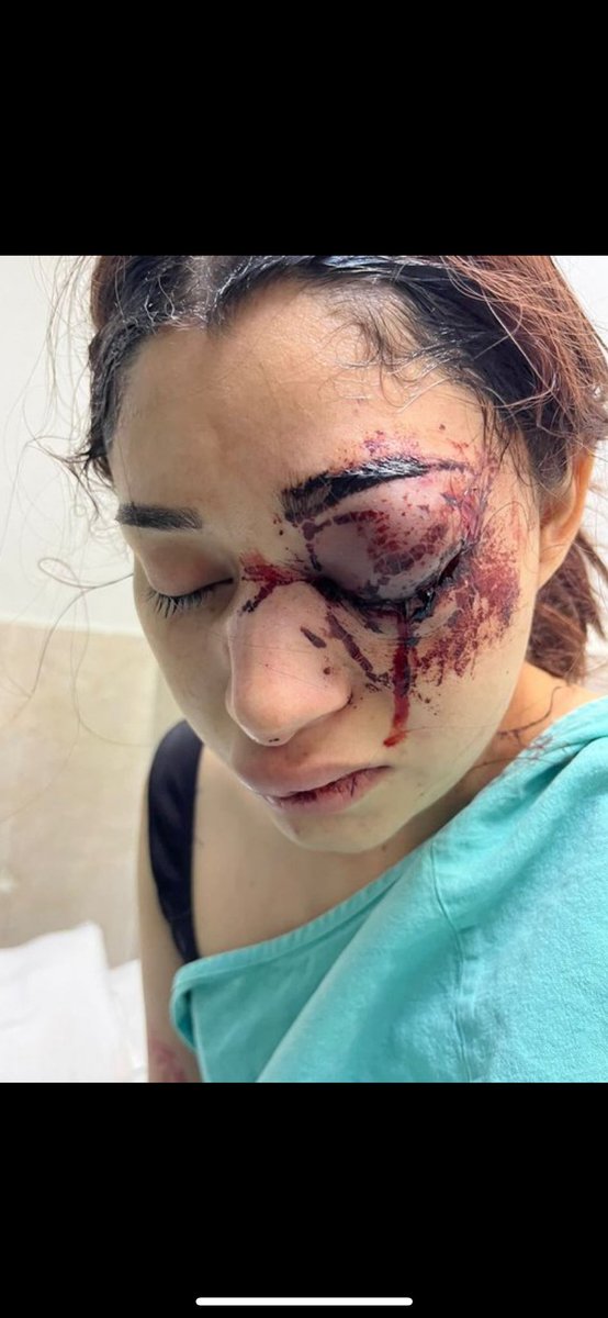 CorresponsalsMX's tweet photo. 🚨Buscan a Christian de Jesús Rojas Martínez por haber golpeado brutalmente a su novia #Melanie

➡️La joven se encuentra en estado de salud delicado a causa de los golpes propinados por Rojas Martínez, quien actualmente se encuentra prófugo. 

#video #viral #noticias https://t.co/xhFmiYGWpp