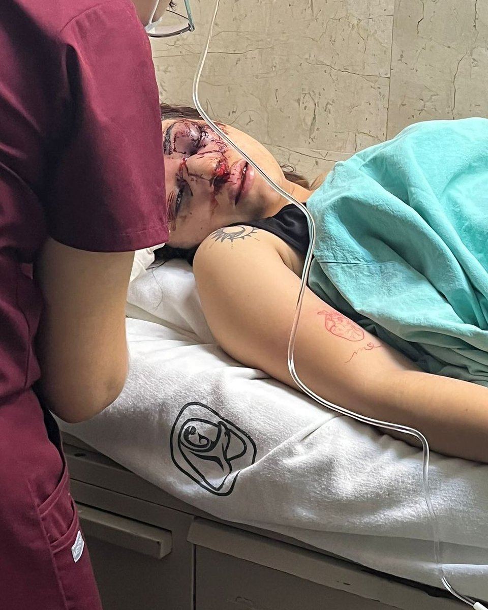 FLAKO_RR's tweet photo. PRÓFUGO
Christian de Jesús Rojas Martínez de 24
años permanece prófugo de la justicia
Después de golear brutalmente a su
novia Melanie, quien permanece en
estado crítico de salud https://t.co/5BgqlnXjfY