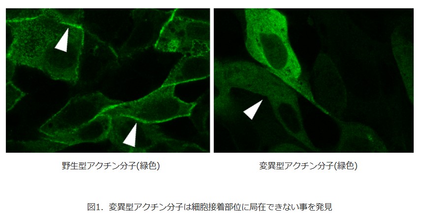 【研究成果】希少疾患「BWCFF症候群」による口唇口蓋裂にアクチン分子の異常動態が関与することを解明hiroshima-u.ac.jp/sci/news/86787　鈴木 誠 助教、荻野 肇 教授は理学部生物科学科の教育・研究も担当しています。　＃広島大学　＃理学部　＃生物科学科　＃両生類研究センター　＃BWCFF症候群