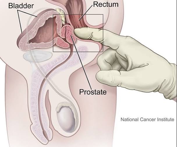 Aku jelasin pakai Bahasa Indonesia ya:
...
"PANDUAN MENYENTUH PROSTAT"
...
1. Jika bentuk Junior kamu bengkok keatas, direkomendasikan gaya Missionary.
2. Jika bengkok kebawah, rekomendasi gaya doggy.
3. Jika Lurus, rekomendasi WOT.
4. Jika bengkok kanan atau kiri, gaya