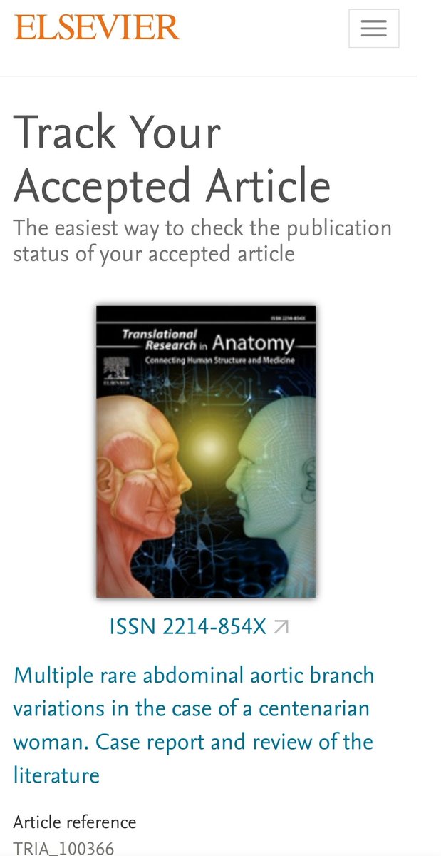Marcello Trucas (@trucasmarcello) on Twitter photo I am so proud!! we discovered a unique case in the literature! Thank you so much <a href="/DS_Barry/">Denis Barry</a>, Claire Lewis, Michela Vincis, to the donors❤️ of <a href="/AnatomyTrinity/">AnatomyTCD</a> I thank you so much, Claire Murphy, Idvaldo Favaretto, and Gavin Mc Manus, Kevin Christopher Conlon, Philomena Mc Ateer I am so proud!! we discovered a unique case in the literature! Thank you so much <a href="/DS_Barry/">Denis Barry</a>, Claire Lewis, Michela Vincis, to the donors❤️ of <a href="/AnatomyTrinity/">AnatomyTCD</a> I thank you so much, Claire Murphy, Idvaldo Favaretto, and Gavin Mc Manus, Kevin Christopher Conlon, Philomena Mc Ateer