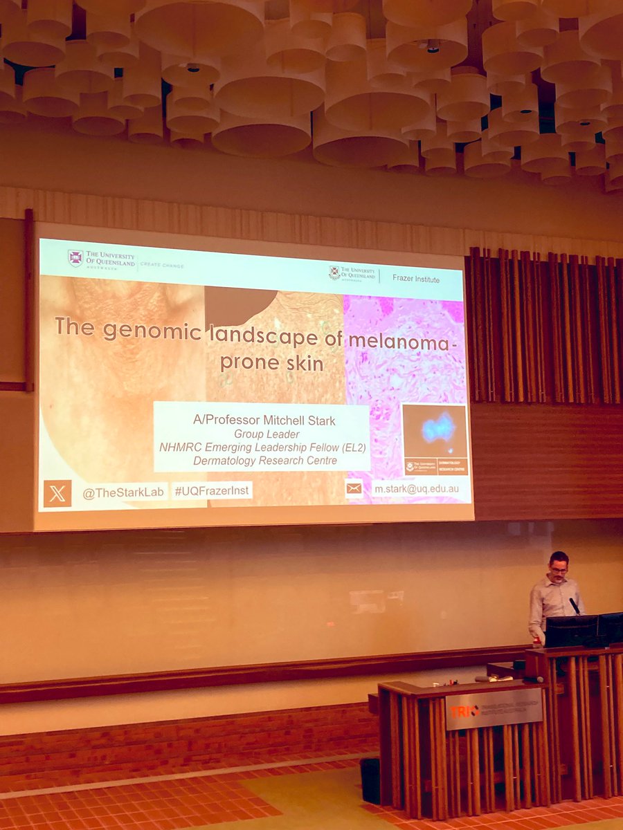 LDousset, MD, PhD (@douss_l) on Twitter photo It’s not only Election Day today—it’s also the day A/Prof Mitch Stark and his team shared insights on melanoma-prone skin and underlying naevi! Fascinating research that brings us closer to understanding skin cancer risks. #MelanomaResearch #SkinCancer #Science <a href="/TheStarkLab/">Mitchell Stark</a> It’s not only Election Day today—it’s also the day A/Prof Mitch Stark and his team shared insights on melanoma-prone skin and underlying naevi! Fascinating research that brings us closer to understanding skin cancer risks. #MelanomaResearch #SkinCancer #Science <a href="/TheStarkLab/">Mitchell Stark</a>