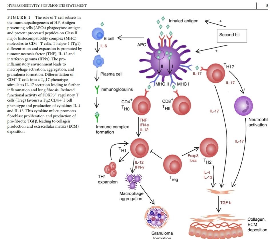 KessnerJp's tweet photo. Neumonitis por Hipersensibilidad: Sociedad Torácica de Australia y Nueva Zelanda.🇦🇺🇳🇿
https://t.co/aPkNqPPA4j
@SeparRespira @ALATorax @Neumosur @NeumoNat @CrisGRebollo @MarisolArLa @HUReinaSofia @neumoparatodos @SPLF_SocPneumo @pneumosbpt @tsanz_thoracic https://t.co/3uGPBdokBJ