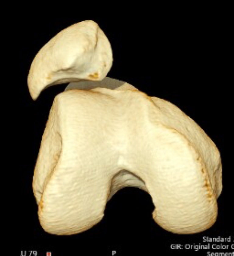 John Fulkerson tweet media