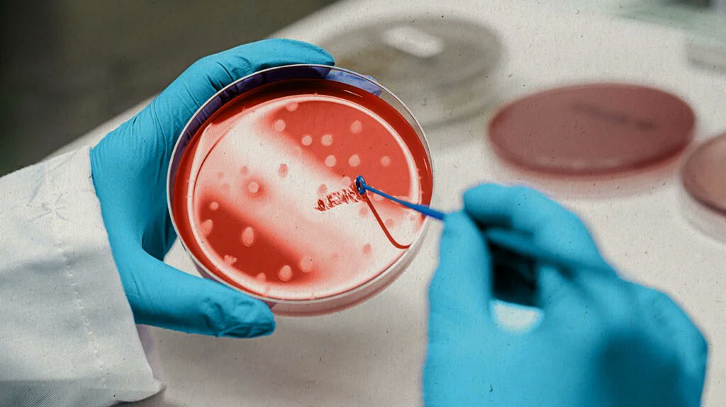 JRegenBiolMed's tweet photo. Stem cell transplants are most often used to treat people with cancers that affect blood cells, such as leukemia, lymphoma, multiple myeloma, and myelodysplastic syndromes.
#cell #transplant #cancer #lymphoma #germcell #tumor #testicular #brain https://t.co/Gp5NWvSkZn