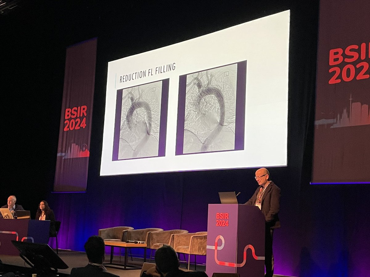 Shahid Seedat (@shahid_seedat) on Twitter photo <a href="/scottydug/">scottydug</a> talking on complicated acute thoracic aortic dissections <a href="/ragsxray/">Raghu</a> <a href="/HullRadiology/">HullRadiology</a> <a href="/NHSHHP/">NHS Humber Health Partnership</a> <a href="/saira_sayeed/">saira sayeed</a> <a href="/scottydug/">scottydug</a> talking on complicated acute thoracic aortic dissections <a href="/ragsxray/">Raghu</a> <a href="/HullRadiology/">HullRadiology</a> <a href="/NHSHHP/">NHS Humber Health Partnership</a> <a href="/saira_sayeed/">saira sayeed</a>