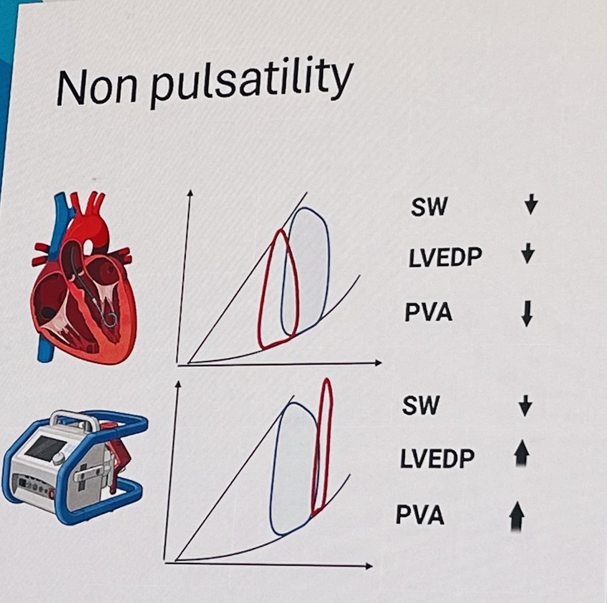 ACI-SEC: Hemodinamica (@shci_sec) on Twitter photo 🔥Fantástica sesión de shock 🫀 con <a href="/thiele_holger/">Holger Thiele</a> y Jacob Moeller en pacientes con SCA en #CSC24
¿ECMO, Impella, ambos, cuándo, a quiénes? 🤔
<a href="/NievesGonzalo1/">Nieves Gonzalo</a> <a href="/OjedaOjeda18/">Soledad Ojeda</a> <a href="/icruzgonzalez/">Ignacio Cruz Gonzalez</a> <a href="/GomezHospita/">JA Gómez Hospital</a> <a href="/AndresIniguezR/">Andrés Íñiguez Romo</a> <a href="/sbrugaletta/">Salvatore Brugaletta</a> <a href="/JuradoRomanAl/">Alfonso Jurado-Román</a> <a href="/oriolrodriguez5/">Oriol Rodriguez</a> <a href="/belcid7/">Belén Cid Alvarez</a> 🔥Fantástica sesión de shock 🫀 con <a href="/thiele_holger/">Holger Thiele</a> y Jacob Moeller en pacientes con SCA en #CSC24
¿ECMO, Impella, ambos, cuándo, a quiénes? 🤔
<a href="/NievesGonzalo1/">Nieves Gonzalo</a> <a href="/OjedaOjeda18/">Soledad Ojeda</a> <a href="/icruzgonzalez/">Ignacio Cruz Gonzalez</a> <a href="/GomezHospita/">JA Gómez Hospital</a> <a href="/AndresIniguezR/">Andrés Íñiguez Romo</a> <a href="/sbrugaletta/">Salvatore Brugaletta</a> <a href="/JuradoRomanAl/">Alfonso Jurado-Román</a> <a href="/oriolrodriguez5/">Oriol Rodriguez</a> <a href="/belcid7/">Belén Cid Alvarez</a>