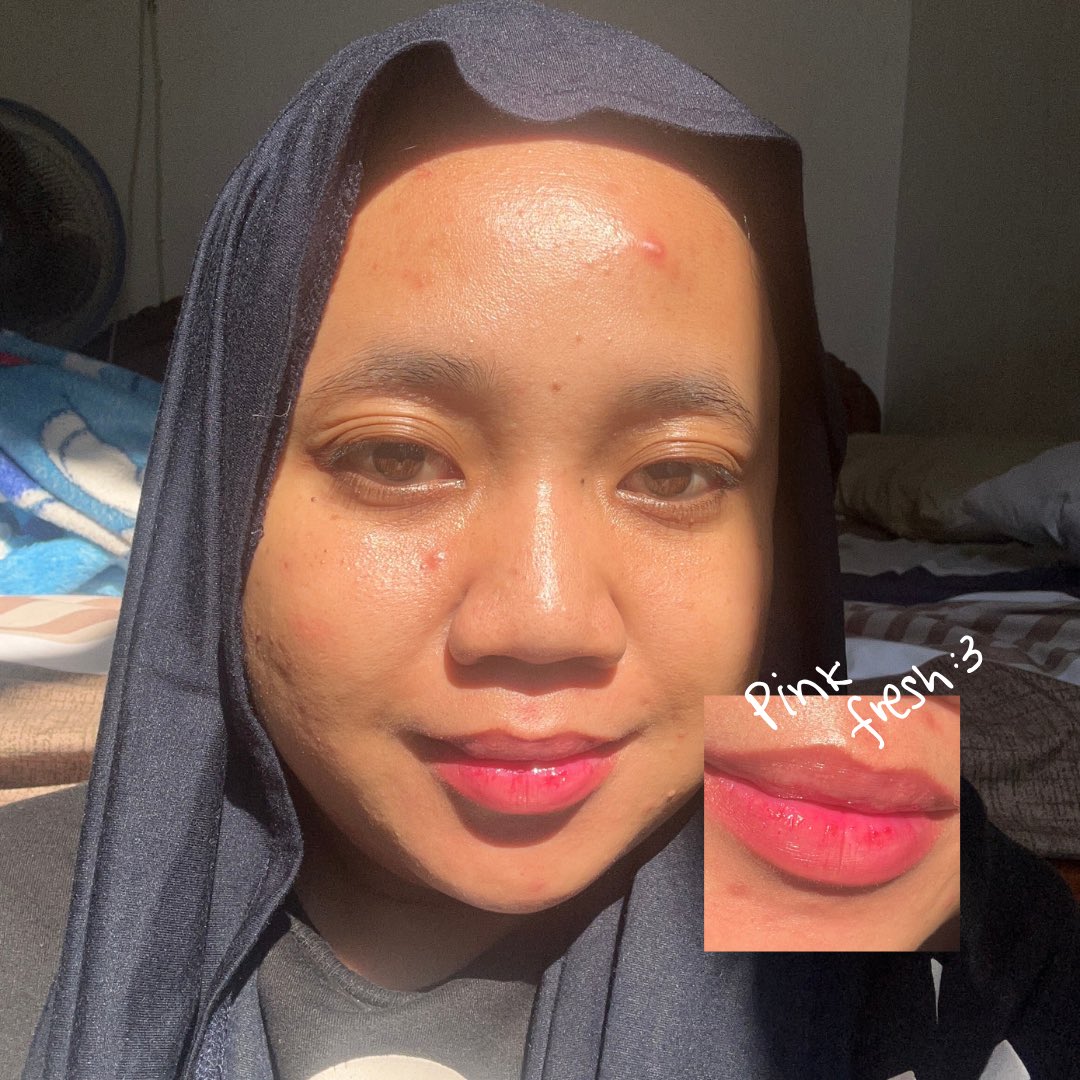 Mana bibir pucet aku? no more :p

dari bibir yang awalnya pucet pasi kering pecah2 jadi pink fresh natural dan plumpyyyy!

(pssstt cuma pake lip serum muehehehe) anw, disini aku mau kasi liat seawet apa bibir pinkishh natural ini 😗👍🏻

#racuninskincare #lipserum