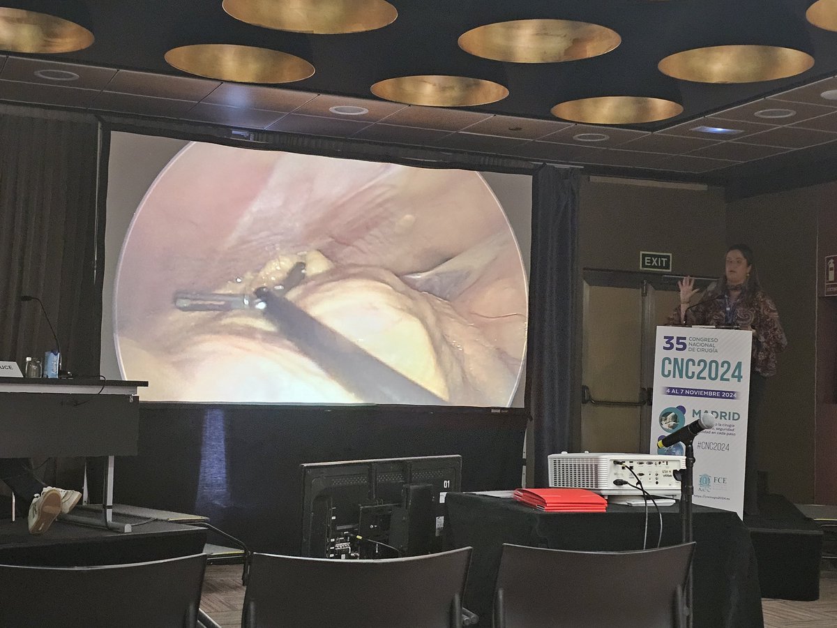 CirugiaJuanRaHuelva (@cirugiahjrj) on Twitter photo 🔎📚 Continuamos con la presentación de nuestras comunicaciones.
Íleo biliar con obstrucción colónica, abordaje laparoscópico.
A cargo de Paula Lara Romero, nuestra R4. <a href="/cnaec2024/">35 Congreso Nacional de Cirugía</a> <a href="/aecirujanos/">aecirujanos</a> <a href="/asacirujanos/">asacirujanos</a> #CNC2024 🔎📚 Continuamos con la presentación de nuestras comunicaciones.
Íleo biliar con obstrucción colónica, abordaje laparoscópico.
A cargo de Paula Lara Romero, nuestra R4. <a href="/cnaec2024/">35 Congreso Nacional de Cirugía</a> <a href="/aecirujanos/">aecirujanos</a> <a href="/asacirujanos/">asacirujanos</a> #CNC2024