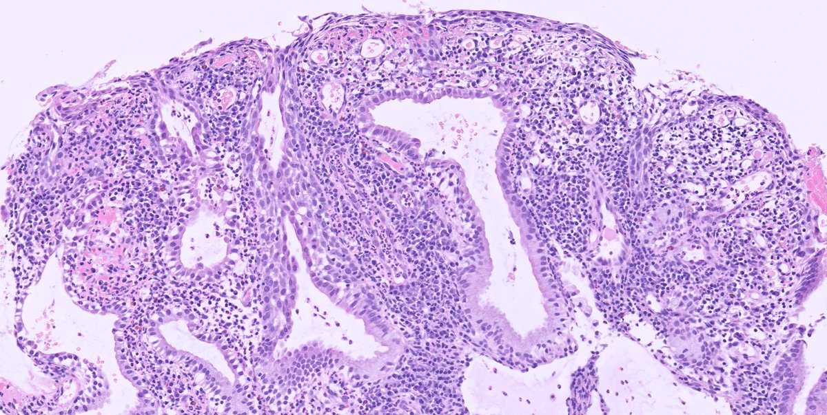 Lorand Kis tweet media