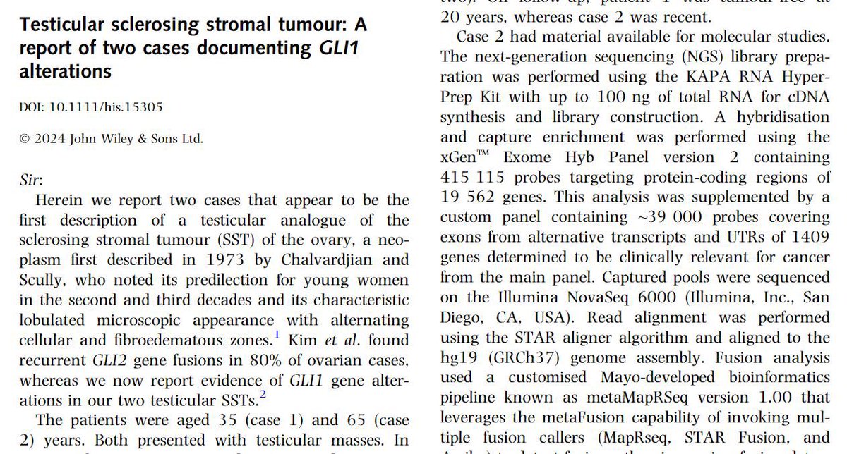 Sounak Gupta (@shounak_gupta) on Twitter photo The biology of germ cell/sex-cord stromal tumors is complex. Highlighting two recent reports from my colleagues <a href="/Justaglomerular/">Loren Herrera MD</a> and <a href="/RDWhaleyMD/">Rumeal D. Whaley, MD</a>
Lots of work being done in this space by <a href="/Andres_M_Acosta/">Andres Martin Acosta (Andy)</a> and <a href="/daniel_berney/">Daniel Berney</a>
Thanks <a href="/Histo_Journal/">Histopathology</a> for highlighting these reports The biology of germ cell/sex-cord stromal tumors is complex. Highlighting two recent reports from my colleagues <a href="/Justaglomerular/">Loren Herrera MD</a> and <a href="/RDWhaleyMD/">Rumeal D. Whaley, MD</a>
Lots of work being done in this space by <a href="/Andres_M_Acosta/">Andres Martin Acosta (Andy)</a> and <a href="/daniel_berney/">Daniel Berney</a>
Thanks <a href="/Histo_Journal/">Histopathology</a> for highlighting these reports