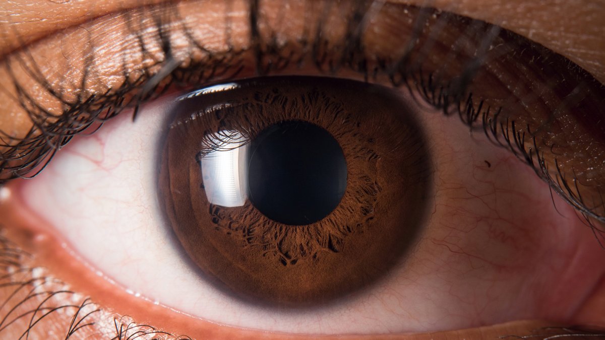 🚨 CMG Update 🚨

The following Clinical Management Guidelines (CMGs) have been reviewed and updated:

☑️ Idiopathic epiretinal membrane
☑️ Keratitis (bacterial, fungal)
☑️ Ophthalmia neonatorum

Members, view a summary of the updates here ➡️ coptom.uk/CMGs