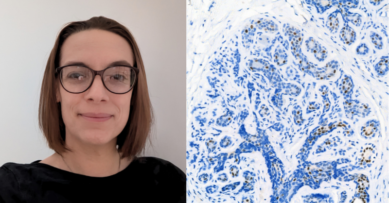 CRUKresearch's tweet photo. Meet @DrHHarrison from @OfficialUoM, our latest #ResearchIsBeautiful image campaign winner🏆 

Hannah’s image captures epithelial cells within an explant taken from normal human breast tissue. Find out more and don’t forget to throw in some festive entries in the coming month!