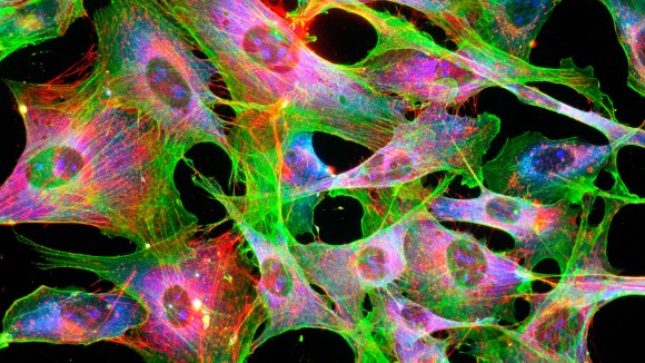 Our Call for Papers with  <a href="/CommsEng/">Communications Engineering</a>,  <a href="/Nature_NPJ/">npj Journals</a>  npj Imaging, <a href="/SciReports/">Scientific Reports</a> and <a href="/NatureComms/">Nature Communications</a> invites research Articles on the topic of microscopic imaging within deep tissue: nature.com/collections/hg…