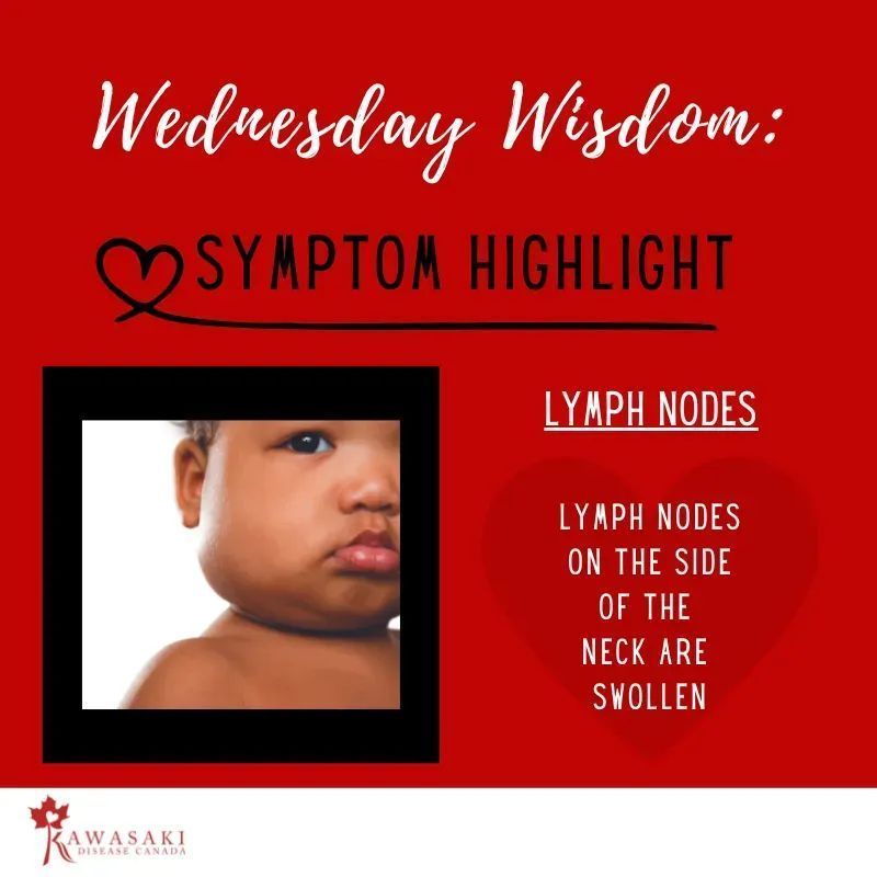 For the last month, we have been #highlighting the most prominent #symptoms of #Kawasakidisease. Knowing the symptoms allows #parents to bring it into the conversation with #primarycare providers sooner and will help avoid delayed and missed diagnoses. #advocate #canadianchildren