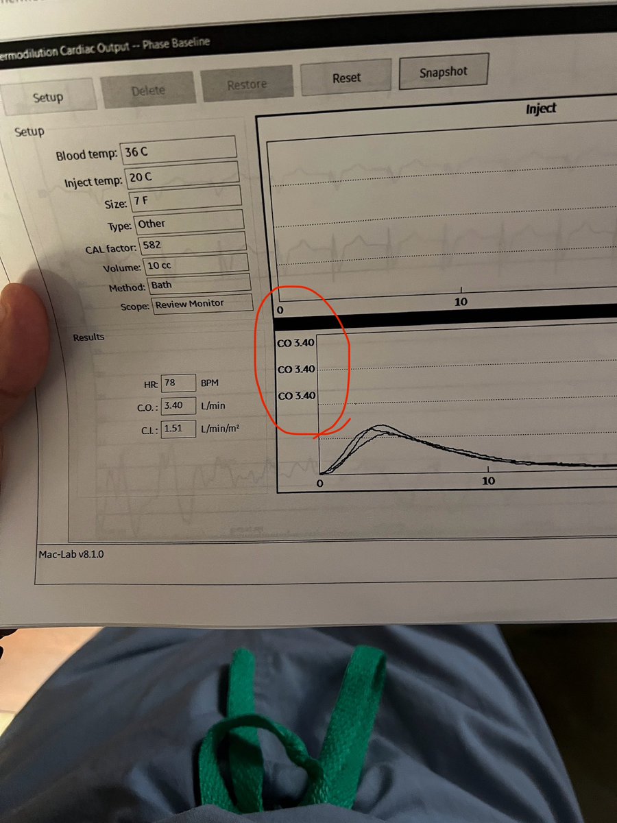 Highlight of my training