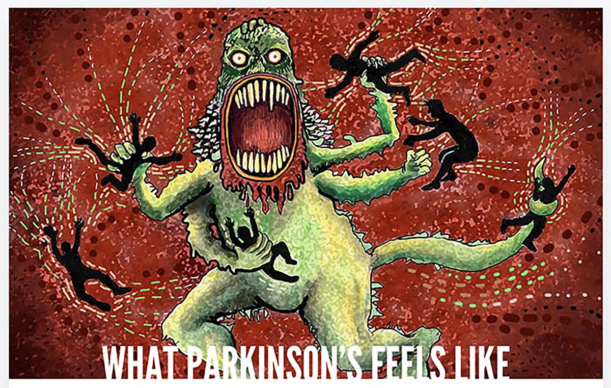 Barbara Salsberg Mathews (@salsbergmathews) on Twitter photo Here's a free ebook on 'What Parkinson's Feels Like'. It's a collaboration with Parkinson's Europe & many people from around globe including: <a href="/plantsbloke/">Carl Beech 🌷</a> <a href="/DaveClarkTV/">Dave Clark</a> <a href="/RichelleFlan/">Richelle Flanagan 💚💚💚💚</a> <a href="/SoaniaMathur/">Soania Mathur, MD</a> <a href="/Florenc44206536/">Nina's pd toolbox</a> <a href="/Giffordtweet/">Larry Gifford</a> and many others parkinsonseurope.org/2024/11/06/wha… Here's a free ebook on 'What Parkinson's Feels Like'. It's a collaboration with Parkinson's Europe & many people from around globe including: <a href="/plantsbloke/">Carl Beech 🌷</a> <a href="/DaveClarkTV/">Dave Clark</a> <a href="/RichelleFlan/">Richelle Flanagan 💚💚💚💚</a> <a href="/SoaniaMathur/">Soania Mathur, MD</a> <a href="/Florenc44206536/">Nina's pd toolbox</a> <a href="/Giffordtweet/">Larry Gifford</a> and many others parkinsonseurope.org/2024/11/06/wha…