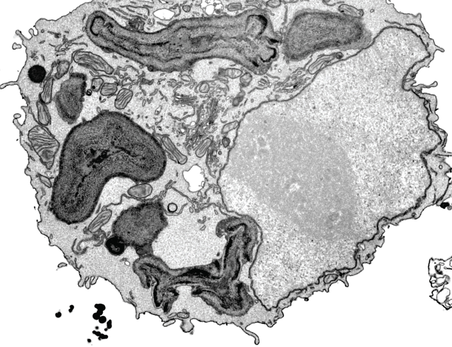 A new Science #Immunology study describes how #APOL7C recruitment to phagosome membranes in conventional #DendriticCells promotes antigen release to the cytosol and cross-presentation. @ucalgaryvetmed <a href="/UCalgary/">U Calgary</a> 
bit.ly/3CjeKWp