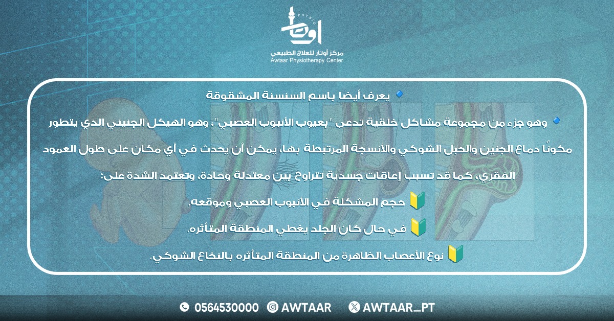 Awtaar_pt's tweet photo. ما هو الصلب المشقوق🤔

📌للحجز والاستفسار برجاء التواصل على 
📞0564530000

#علاج_طبيعي #تأهيل_الأطفال #تأهيل_حركي #العلاج_الوظيفي #خشونة_الركبة #خشونة_المفاصل https://t.co/wg9JwSAUjF