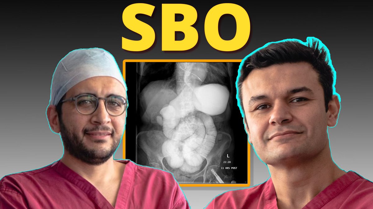 Intrigued by small intestine obstruction for your FRCS Viva? Whether it piques your interest or not, check out our latest episode on YouTube or Spotify.