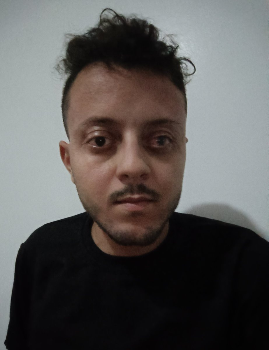 My eye is still hurting me, and i will go to the doctor again in the morning. 

Please don't forget me from your prayers.
gofund.me/e72769fc