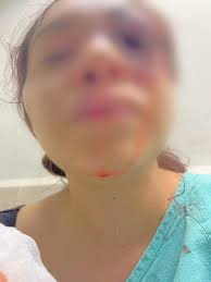 Territorio_Mex's tweet photo. Este hijo de la chingada, CHRISTIAN DE JESUS ROJAS MARTINEZ, casi mata a su #novia  a golpes en #Tamaulipas. Ya tiene ficha de busqueda, #RT para e que  tenga justicia #MelaniedeJesús, estudiante de la #UAT.
#FGJT_Recompensas  #JusticiaParaMelanie https://t.co/kaWbL56SHV
