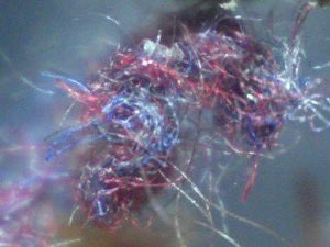 Controversial 'Morgellons Disease' causing red,white and blue fibers protruding from the skin. 
Is it a Delusory Parasitosis  or a medical condition?
amp.theguardian.com/lifeandstyle/2…