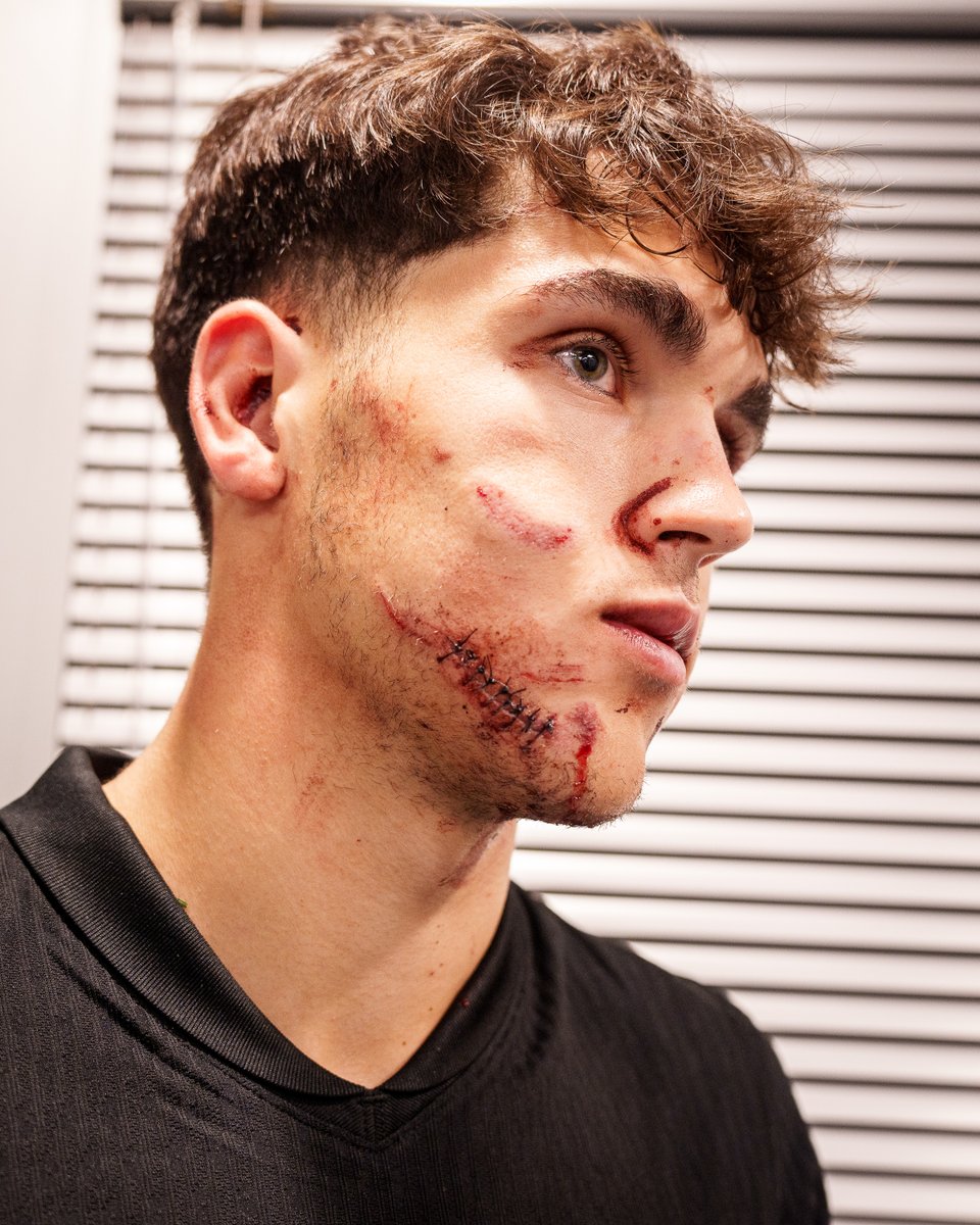 fcbarcelona_fra's tweet photo. Pau Cubarsi, ce guerrier catalan https://t.co/904neM7FjS
