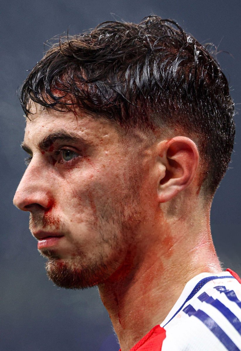 leafricangooner's tweet image. Our German Warrior 🇩🇪

We go again against Chelsea 🙏🏾