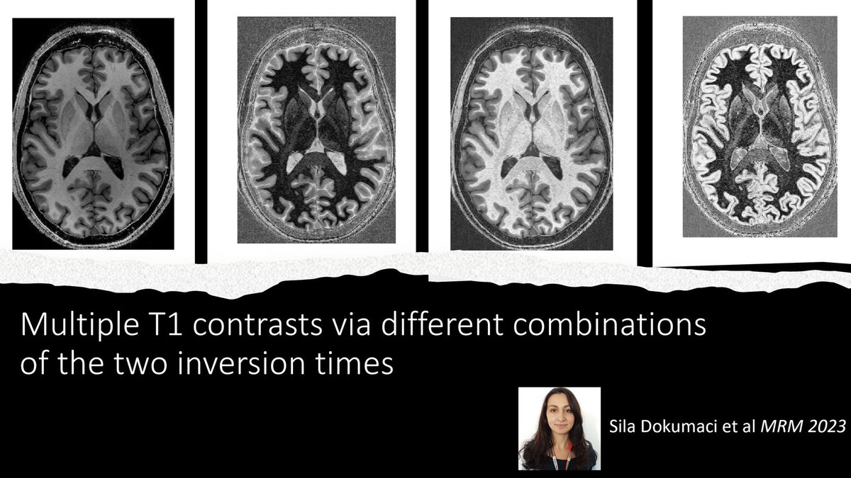 Irene Wang, PhD, FAES tweet media