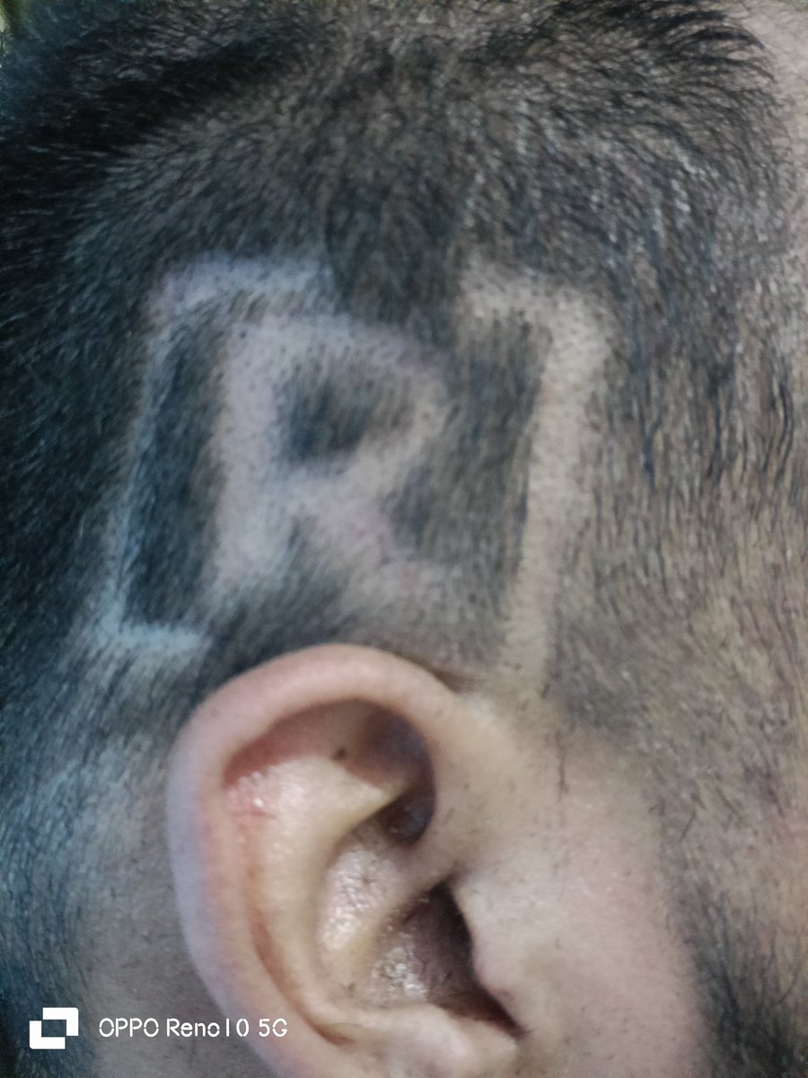 guzllex's tweet photo. Estamos ready para mañana!🔥@residente con todo y cabestrillo! https://t.co/CN2x1i98b5