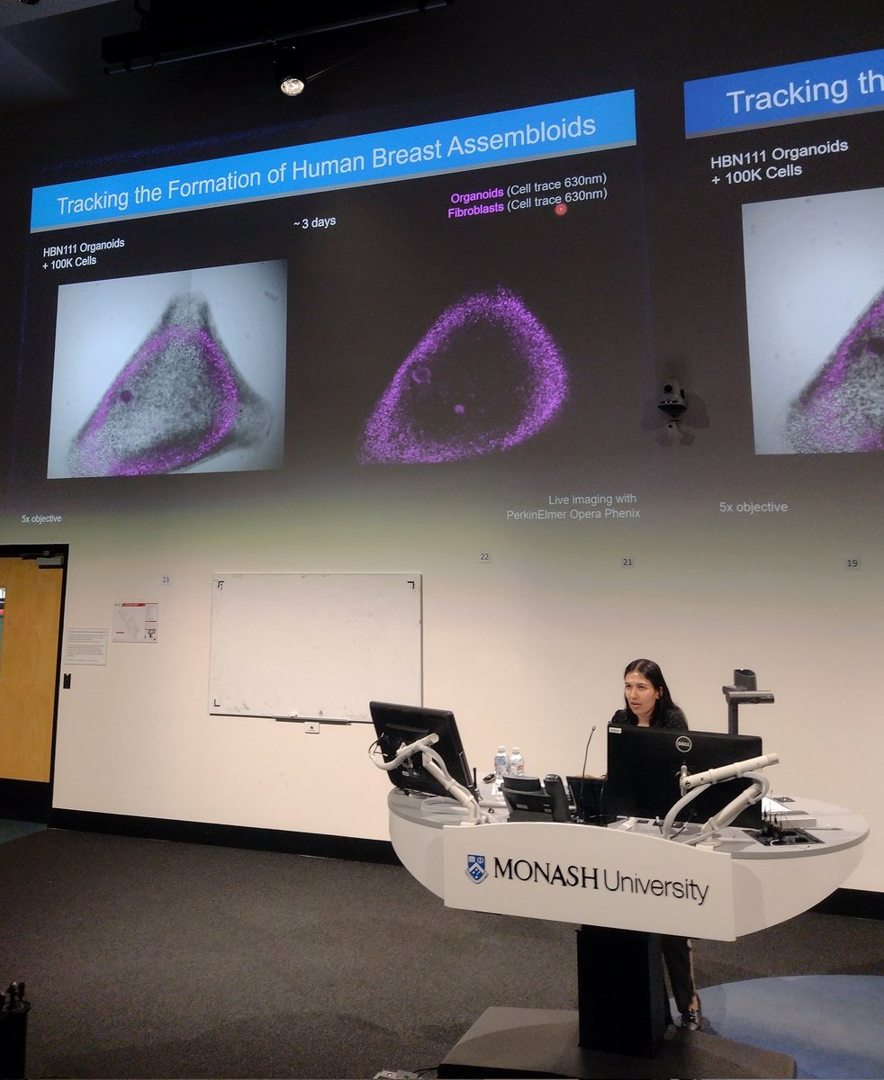 Monash BDI Organoid Program (@monashorganoids) on Twitter photo Our Monash Organoid Program Breast tissue expert <a href="/Jas12K/">Jasveena Kaur</a> presenting her assembloids, building more complexity in patient-derived organoids Our Monash Organoid Program Breast tissue expert <a href="/Jas12K/">Jasveena Kaur</a> presenting her assembloids, building more complexity in patient-derived organoids