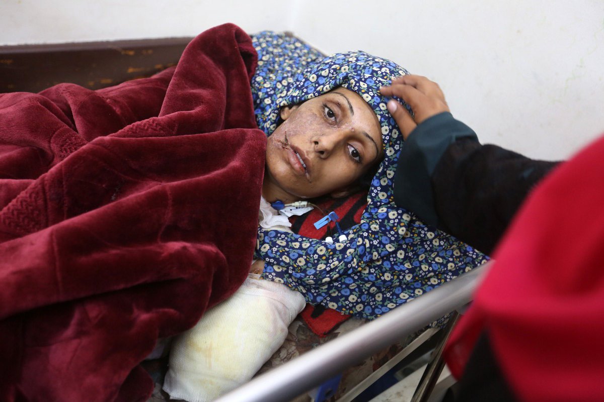 My cousin, Rana Dalloul, 35..

👉🏼She obeyed the orders of israeli occupation forces, left her house in #Gaza_City and moved to the alleged safe zones in the south!

👉🏼She has lost 2 little sons in #israeli_bombing of Al Nuseirat School two weeks ago!

👉🏼She had her left arm