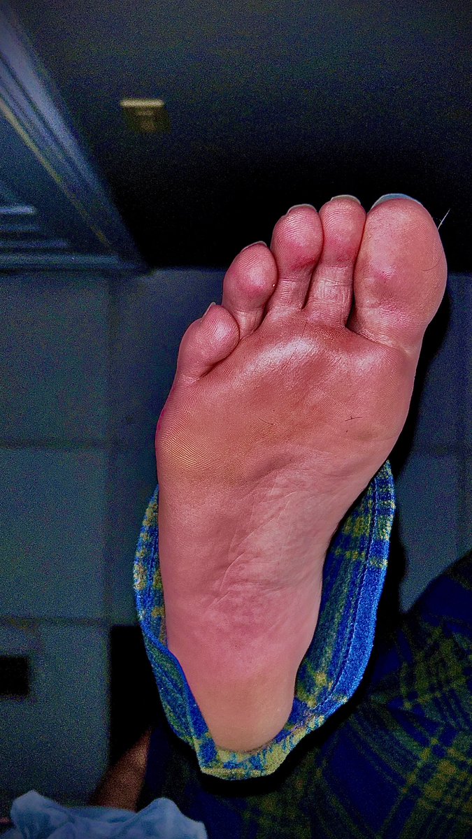 DefeetofFace's tweet image. New photo shoot, start your edging streak!