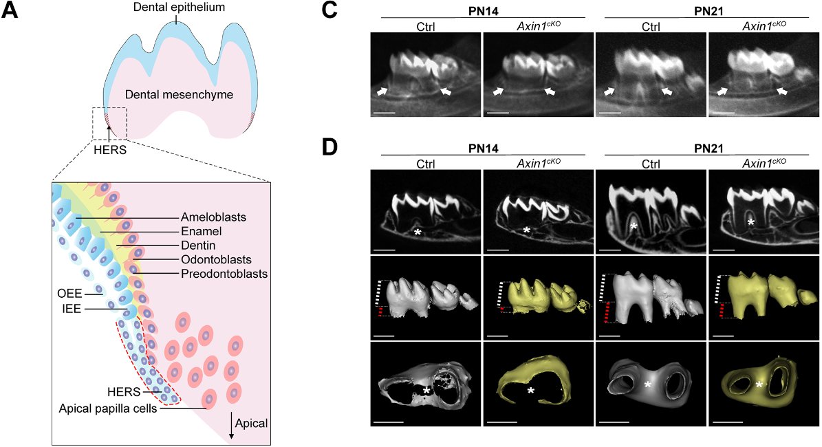 Development (@dev_journal) on Twitter photo Axin1 regulates tooth root development by inhibiting AKT1-mTORC1 activation and Shh translation in Hertwig's epithelial root sheath
Read this #OpenAccess Research Article by Xiaoyu Zheng, Hongcan Huang, Guohua Yuan and colleagues:
journals.biologists.com/dev/article/15… Axin1 regulates tooth root development by inhibiting AKT1-mTORC1 activation and Shh translation in Hertwig's epithelial root sheath
Read this #OpenAccess Research Article by Xiaoyu Zheng, Hongcan Huang, Guohua Yuan and colleagues:
journals.biologists.com/dev/article/15…