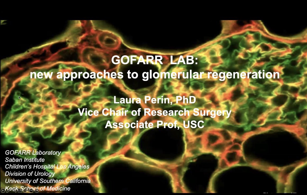Stony Brook Nephrology & Hypertension Division (@sbnephrology) on Twitter photo Thank you Dr. Laura Perin <a href="/GOFARRLAB/">GOFARR Lab</a> <a href="/KeckMedicineUSC/">Keck Medicine of USC</a> for your excellent talk at this week’s research seminar ⬇️ Thank you Dr. Laura Perin <a href="/GOFARRLAB/">GOFARR Lab</a> <a href="/KeckMedicineUSC/">Keck Medicine of USC</a> for your excellent talk at this week’s research seminar ⬇️