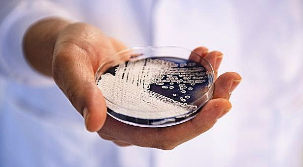 BLOG - How, and why, do plants and microbes interact?

Microbes have evolved over the past 3.5 billion years to survive in diverse habitats, including in/on plants. But whilst some are beneficial, others can cause devastating diseases <a href="/micronorwich/">Centre for Microbial Interactions</a>

okt.to/318Qak