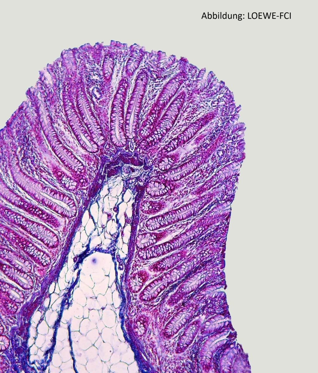 ProLOEWE (@proloewe) on Twitter photo HEUTE=#TAG_DER_DARMGESUNDHEIT+wie mittlerweile viele wissen beginnt die #Gesundheit im #Darm! LOEWE-<a href="/FCI_health/">Frankfurt Cancer Institute</a> forscht intensiv an neuen Therapien💊gegen #Darmkrebs, um Betroffenen eine bessere Behandlung🩺+größere Heilungschancen zu ermöglichen.<a href="/goetheuni/">Goethe-Universität</a> <a href="/mpi_hlr/">Max Planck Institute for Heart and Lung Research</a> <a href="/PEI_Germany/">Paul-Ehrlich-Institut</a> HEUTE=#TAG_DER_DARMGESUNDHEIT+wie mittlerweile viele wissen beginnt die #Gesundheit im #Darm! LOEWE-<a href="/FCI_health/">Frankfurt Cancer Institute</a> forscht intensiv an neuen Therapien💊gegen #Darmkrebs, um Betroffenen eine bessere Behandlung🩺+größere Heilungschancen zu ermöglichen.<a href="/goetheuni/">Goethe-Universität</a> <a href="/mpi_hlr/">Max Planck Institute for Heart and Lung Research</a> <a href="/PEI_Germany/">Paul-Ehrlich-Institut</a>