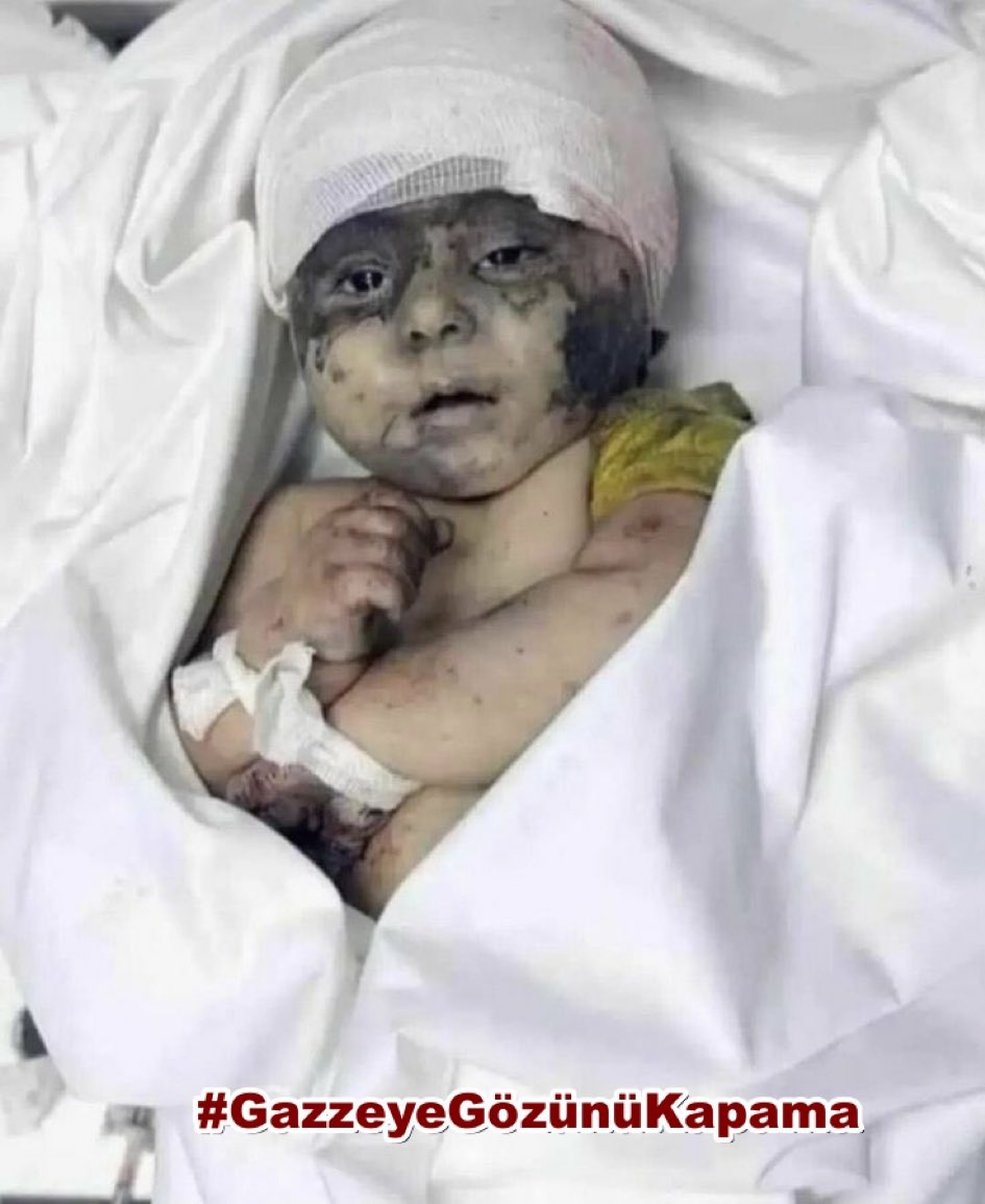Laiba Palestine 🇵🇸 tweet media