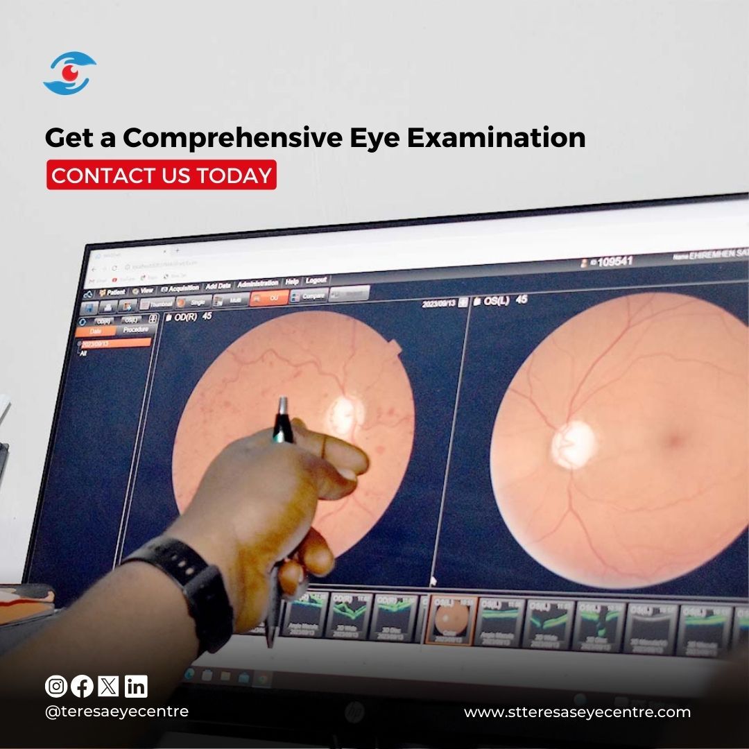 teresaeyecentre's tweet photo. Visit an ophthalmologist today.

Contact us 08036996388 or 09165437271

#EyeHealth #OCTScan #VisionCare #teresaseyecentre https://t.co/LwvfFhs2mA