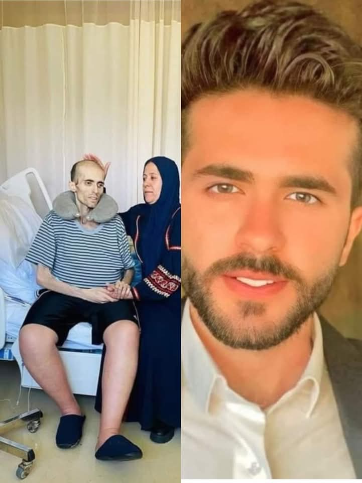 MoMegdadi's tweet photo. لاحول ولا قوة الا بالله العلي العظيم 
الصورة للشاب أيمن العلي  "ملك جمال الأردن" كما كان يحب ان يلقب نفسه عمر 22سنة اكتشف مرضه بسرطان المعدة بعد شعوره بألام حاد في بطنه
الصورة بعد جرعات العلاج الكيماوي، مطلوب منا جميعًا الدعاء له.😔👇
شفاه الله وعافاه وألبسه ثوب الصحة والعافية https://t.co/wu2ESDcuhS